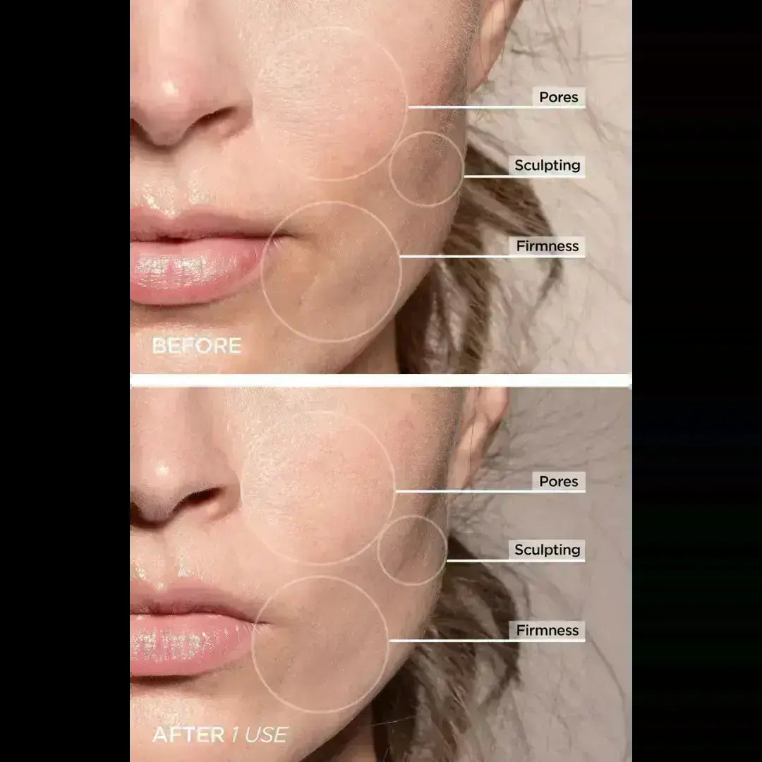 LUMINESCE 7-In-1 LED Facial Sculptor