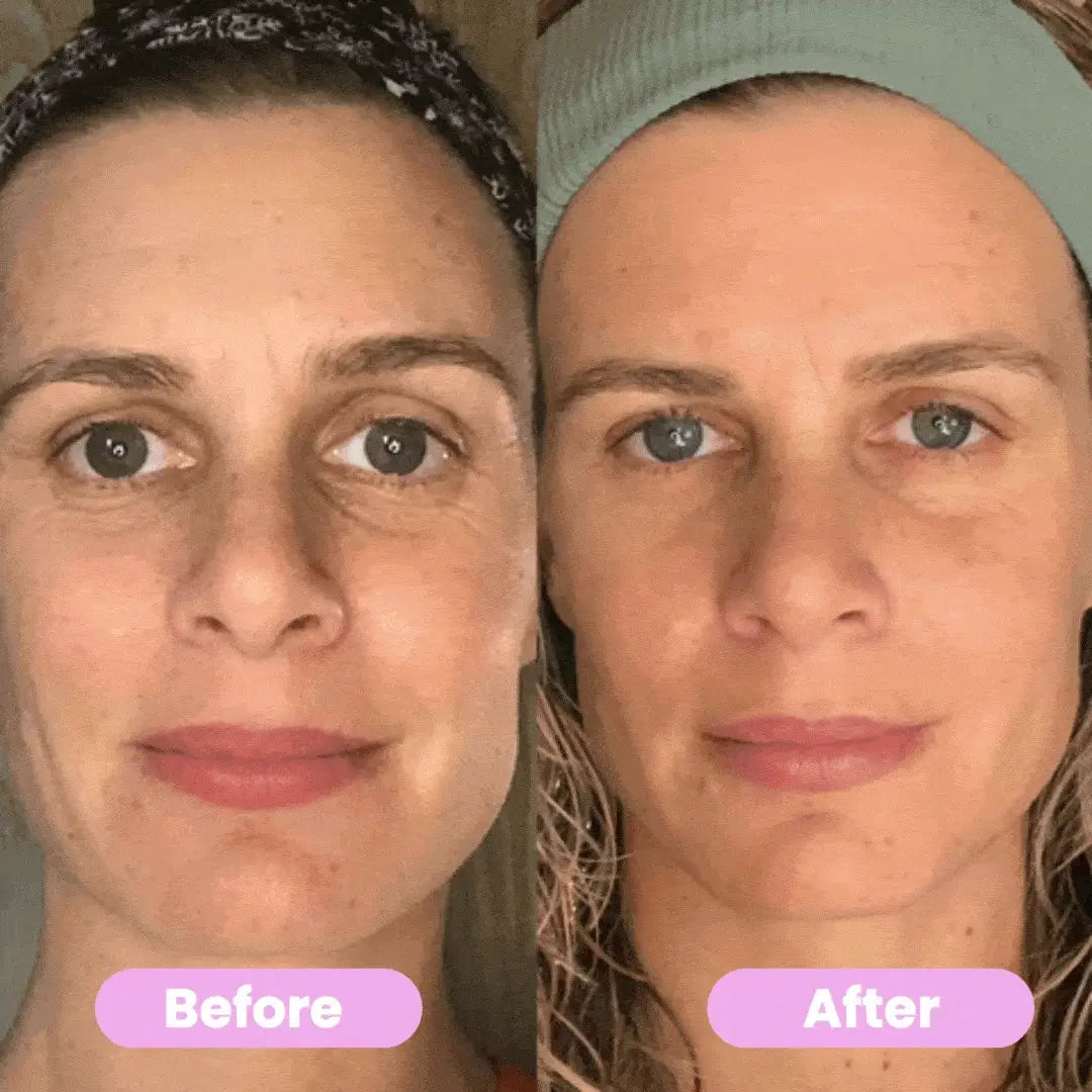 LUMINESCE 7-In-1 LED Facial Sculptor